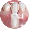 Holistic Surgical Services