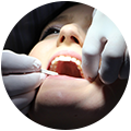 Root Canal Treatment