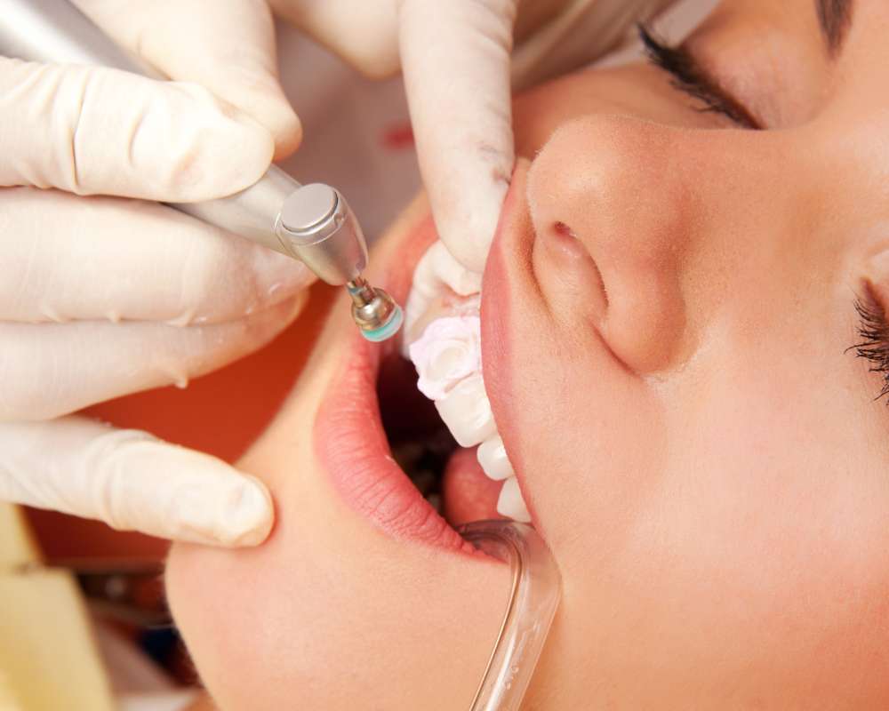 Dental Hygienist Services at Fendalton Dental in Christchurch